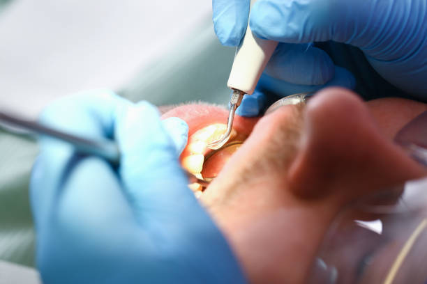 Best Emergency Dentist for Knocked-Out Tooth in Maineville, OH